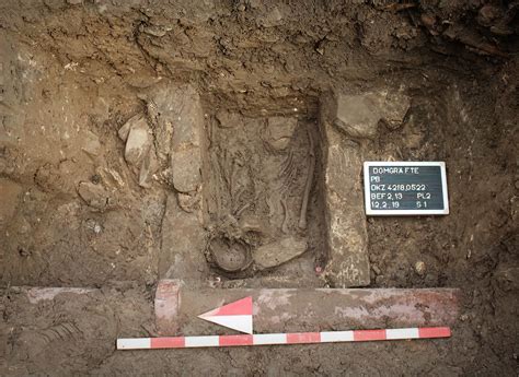 Frühester Fall Des Down-Syndroms Auf Mittelalterlichem Friedhof Entdeckt