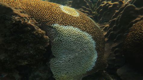 Germenul De La Human Feces Face Un Salt Mortal Către Coral