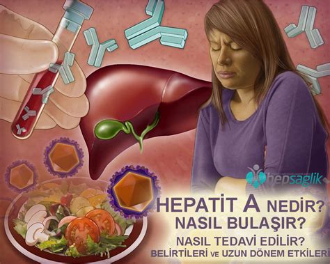 Hepatit: Belirtileri, Tedavisi Ve Önlenmesi