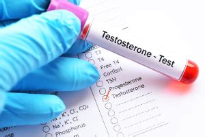 Højt Testosteron Forbundet Med Prostatakræftrisiko