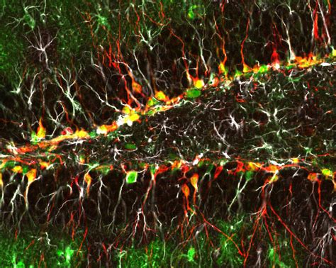 Noi Imagini Detectează Celulele Creierului „Snacking” Evazive