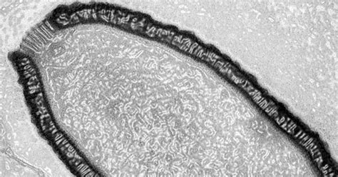 Riesenvirus Nach 30.000 Jahren Aus Permafrost Wiederbelebt