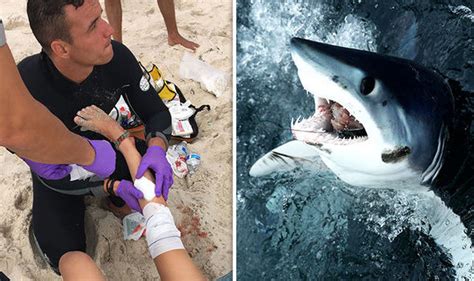 Shark Bites Two: Mulige Forklaringer For Angreb