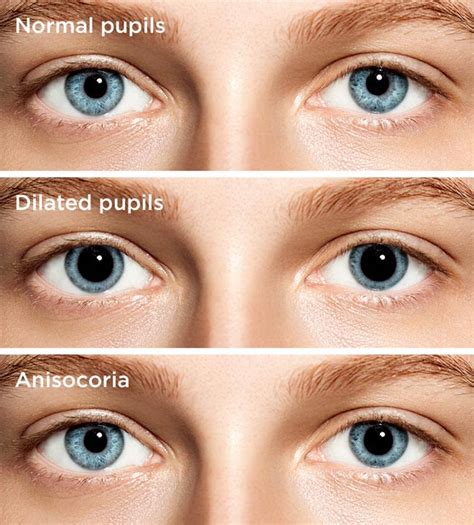The Eyes Have It: Pupil Dilation Geeft Seksualiteit Aan