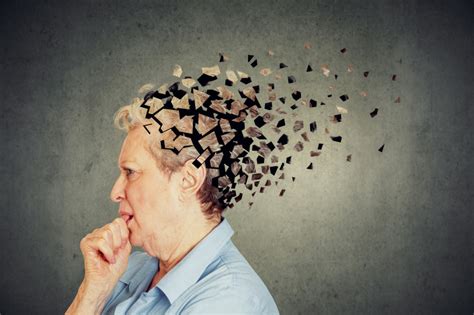 Veselīgu Pērtiķu Smadzenēs Var Būt Alcheimera Izārstēšanas Atslēga