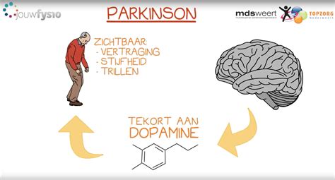 Wat Is De Oorzaak Van De Ziekte Van Parkinson?