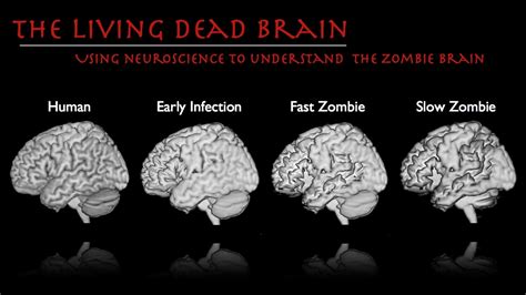 Zombie Neuroscience: Inside The Brains Of The Walking Dead