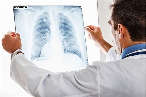 Ārsti Ziņo, Ka Tuberkuloze Tagad Ir Praktiski Neārstējama